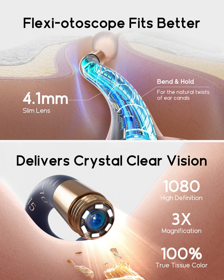 2025 New Bebird I35R Visual Ear Cleaner EarSight HD Clipable Tweezers Earpick Wireless Clean Endoscope Mini Camera Health care