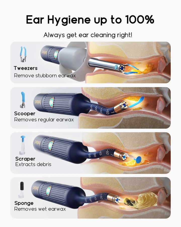 2025 New Bebird I35R Visual Ear Cleaner EarSight HD Clipable Tweezers Earpick Wireless Clean Endoscope Mini Camera Health care
