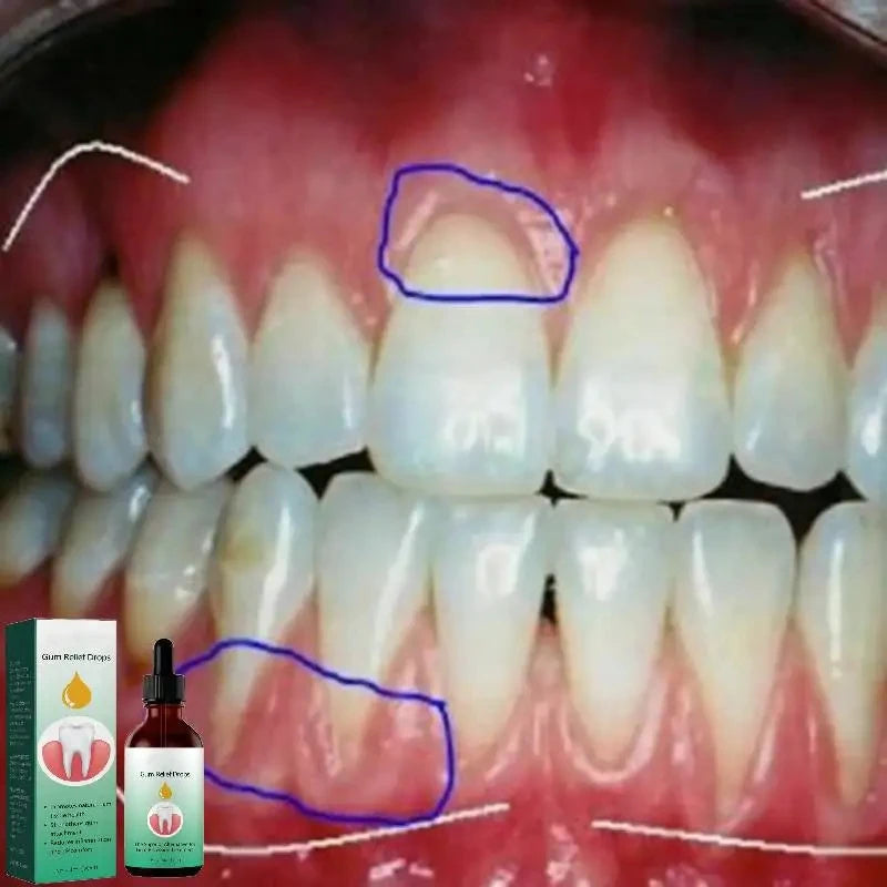 30ml Gum Repair Drops Relieve Receding Gingival Swelling Gum Cleaning Oral Periodontal Hygiene Remove Stain Remove Yellow Tartar
