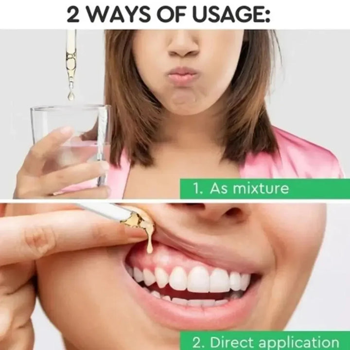 30ml Gum Repair Drops Relieve Receding Gingival Swelling Gum Cleaning Oral Periodontal Hygiene Remove Stain Remove Yellow Tartar