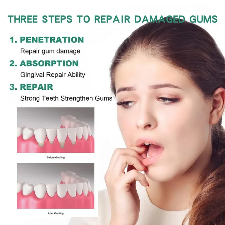 30ml Gum Repair Drops Relieve Receding Gingival Swelling Gum Cleaning Oral Periodontal Hygiene Remove Stain Remove Yellow Tartar